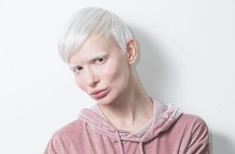 Алиса Лисс перенесла рак